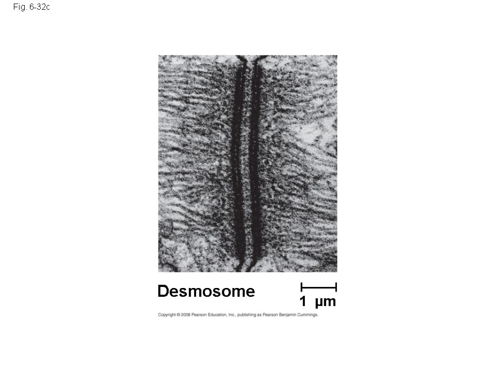 Fig. 6-32c Desmosome 1 µm